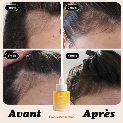 The magic potion - Hair transformation