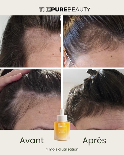 The magic potion - Hair transformation